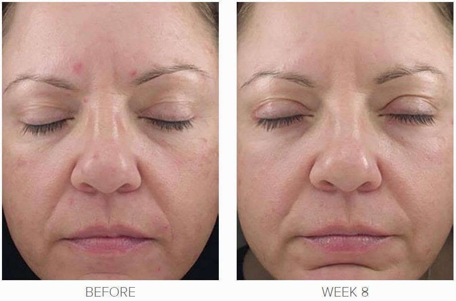 Obagi 360 is an ideal answer for early intervention to proactively address dull, uneven skin texture and | BeautifulSkincareSite.com